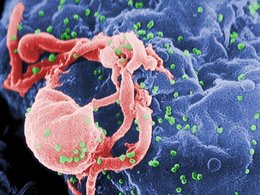 Вирионы ВИЧ отпочковываются от зараженного лимфоцита