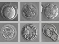 Человеческий эмбрион, развивающийся в пробирке. С сайта nobelprize.org
