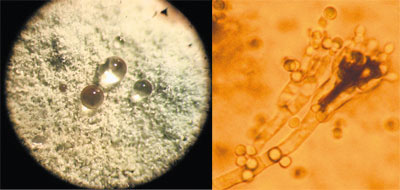 Пенициллиум оранжево-серый (Penicillium aurantiogriseum) — типичный обитатель почв. Увеличение в 400 раз (справа).