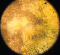  Триходерма чёрно-зелёная (Trichoderma atroviride). Из неё делают препарат триходермин для защиты растений от поражения другими грибами.