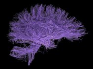 Визуализация нервных волокон мозга