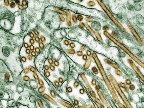 Электронная микрофотография вируса птичего гриппа A H5N1