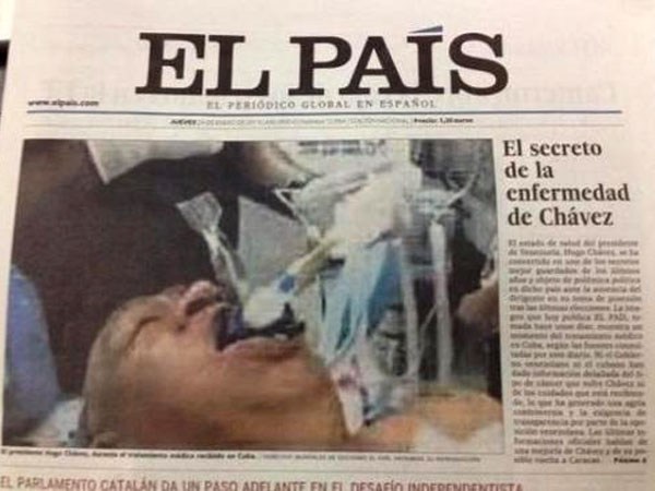 Номер El Pais с фальшивым Чавесом во время интубации