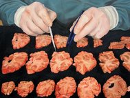 Дэмиен Хёрст, Autopsy with Sliced Human Brain, 2004