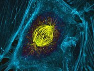 Митотическое веретено в делящейся клетке. Фото: Pat Wadsworth/Olympus BioScapes