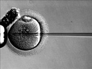 Инъекция сперматозоида в яйцеклетку