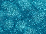 Эмбриональные стволовые клетки человека
