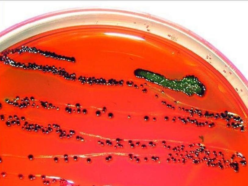 Колонии E. coli в чашке Петри