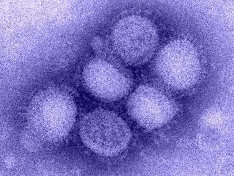 Вирус H1N1 под электронным микроскопом