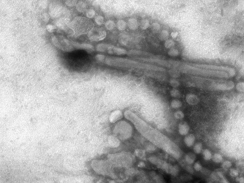 Вирус гриппа H7N9 под электронным микроскопом