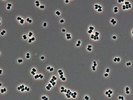 Tersicoccus phoenicis
