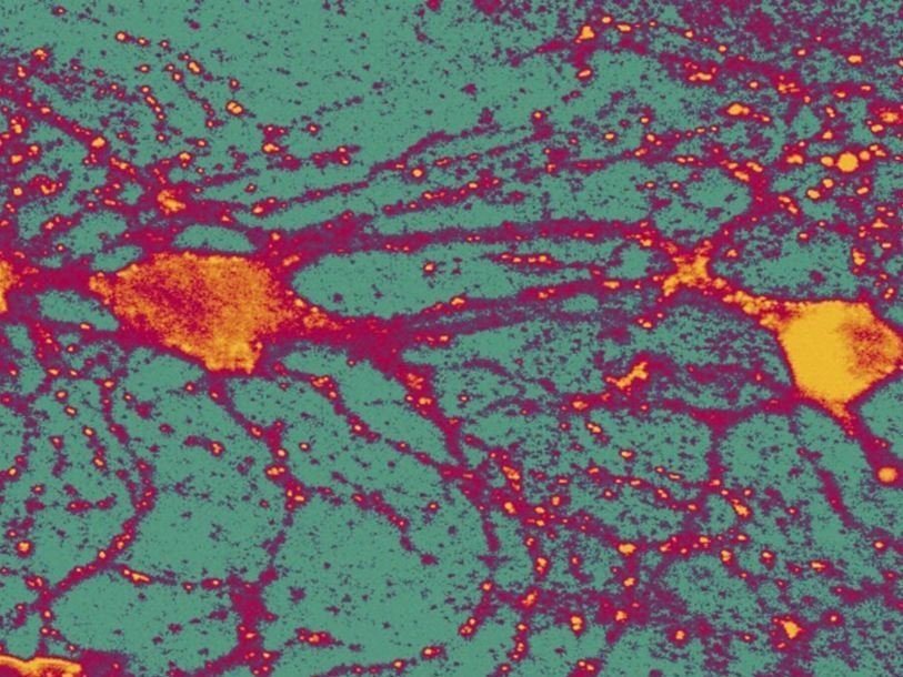 Нейроны гиппокампа