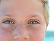 Меланины отвечают за окраску кожи, волос и глаз