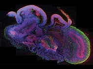 «Мини-мозг», выращенный из стволовых клеток в Институте молекулярной биологии в Австрии