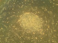Эмбриональные стволовые клетки человека