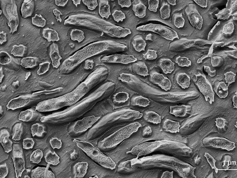 Бактерии рода Magnetospirillum под растровым электронным микроскопом