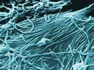 Вирионы Эбола под электронным микроскопом