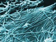 Вирионы Эбола под электронным микроскопом