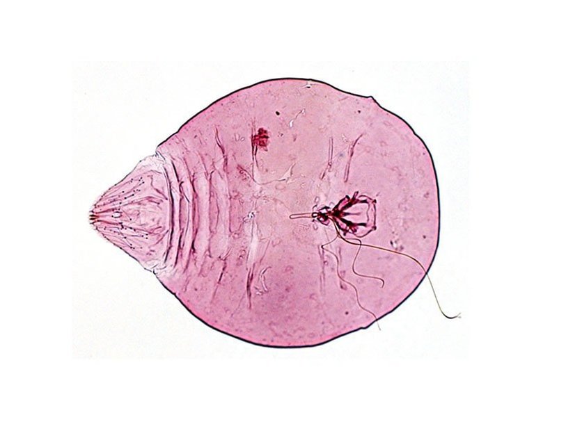 Aspidiotus rigidus под микроскопом