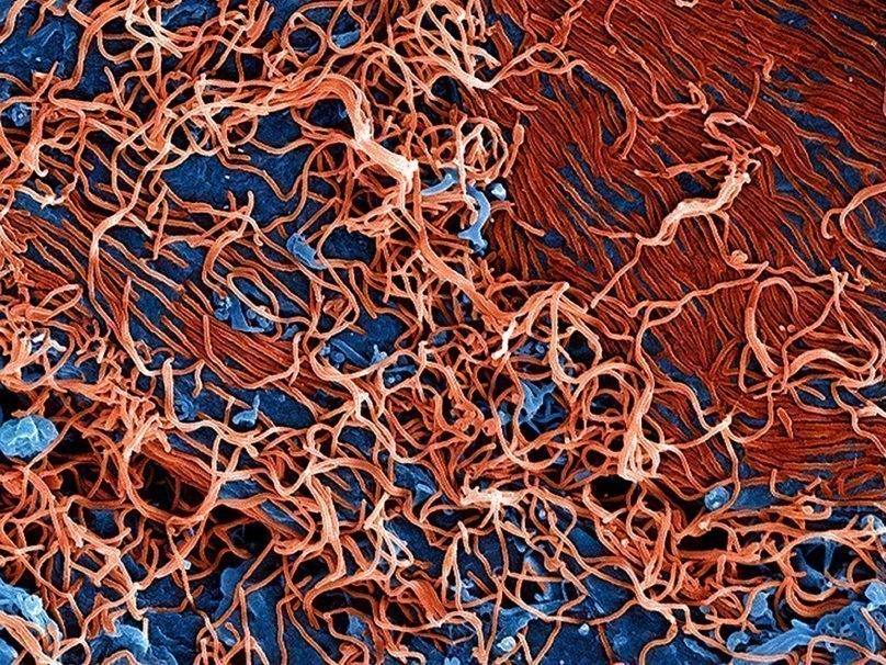 Вирионы Эбола под растровым электронным микроскопом