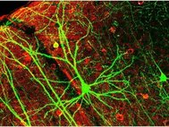 Пирамидальный нейрон гиппокампа, окрашенный при помощи зеленого флуоресцентного белка