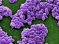 Споры бактерии Bacillus anthracis под электронным микроскопом