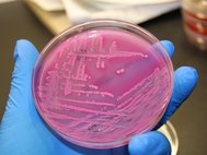 E. coli в чашке Петри