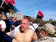 Избиение депутата Шуфрича на Украине