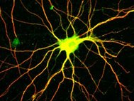 Нейрон с дендритами