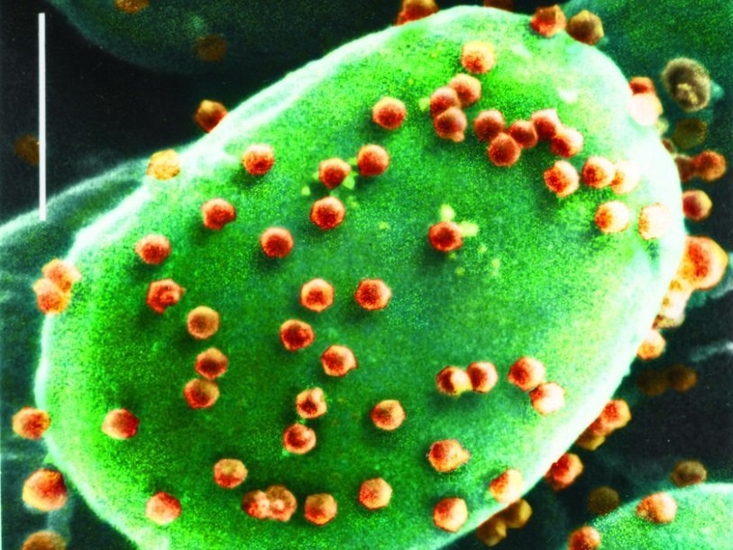 Зараженная родственным ACTV-1 вирусом водоросль