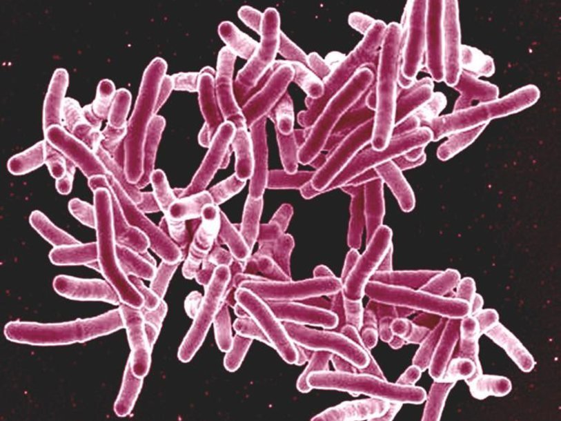 ps_Mycobacterium_tuberculosis_1675758800