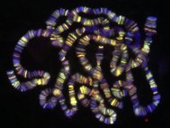 Хромосомы из клеток слюнных желез дрозофилы
