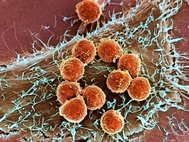 Т-лимфоциты на раковой клетке