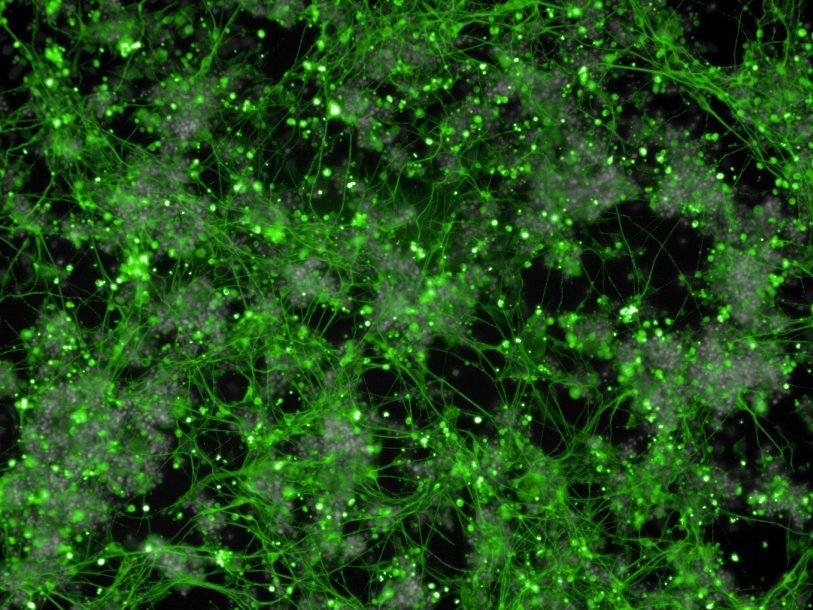 Нейроны, полученные из клеток крови