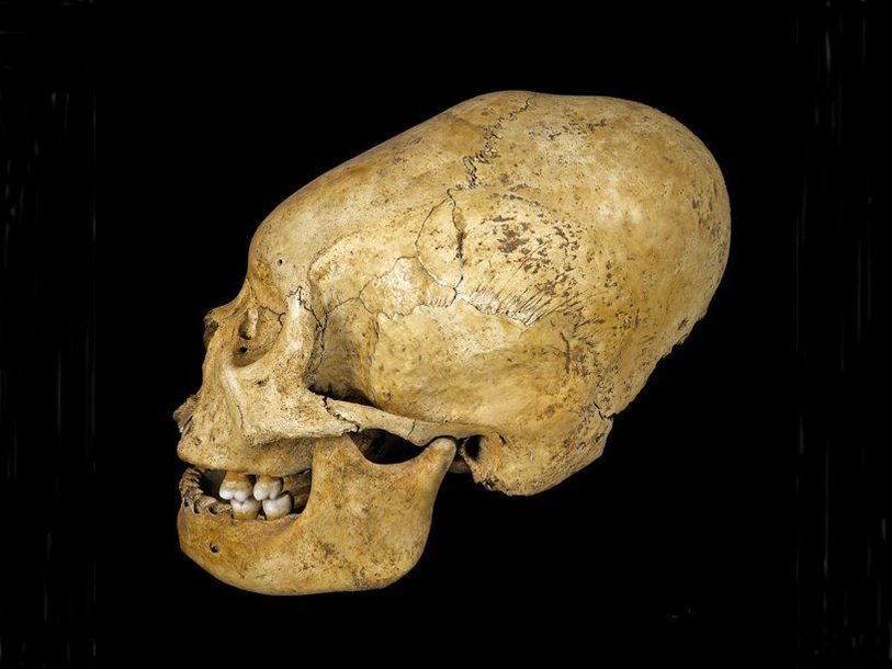Искусственно вытянутый череп. Культура прото-наска, Перу, 200-100 года до н.э.
