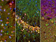 Участки мозга мыши, где были найдены перинейрональные сети