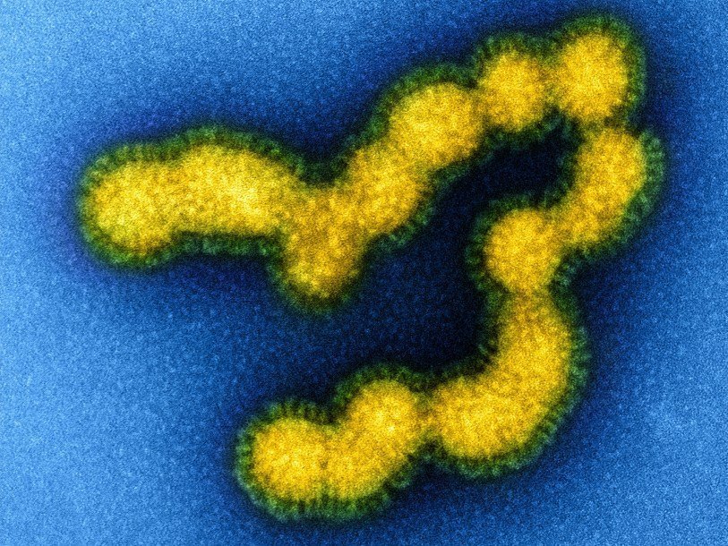 Вирусные частицы свиного гриппа