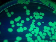 Колонии бактерий E. coli, окрашенные зеленым флуоресцентным протеином