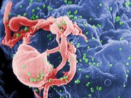Вирусы ВИЧ (отмечены зеленым) отпочковываются от зараженного лимфоцита. Фотография получена с помощью сканирующего электронного микроскопа