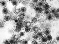 Вирус человеческого герпеса первого типа под электронным микроскопом