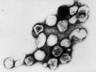 Вирус краснухи под электронным микроскопом