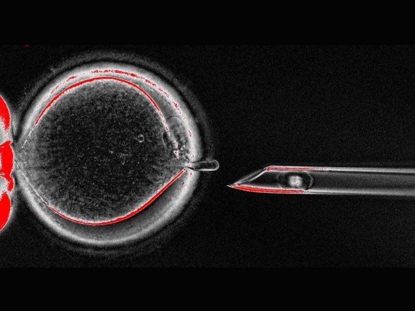 Извлечение генетического материала из неоплодотворенной яйцеклетки