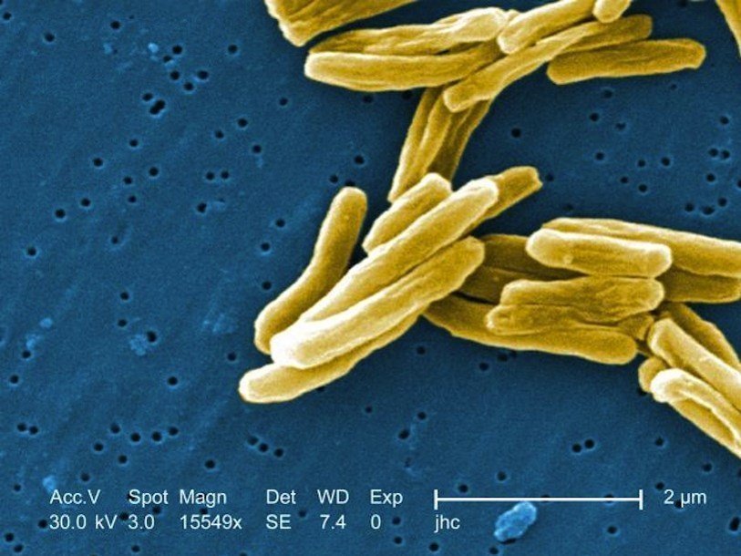 Туберкулезные бактерии под электронным микроскопом