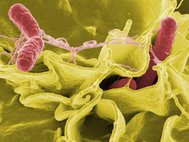 Бактерии Salmonella typhimurium в культуре человеческих клеток под растровым электронным микроскопом