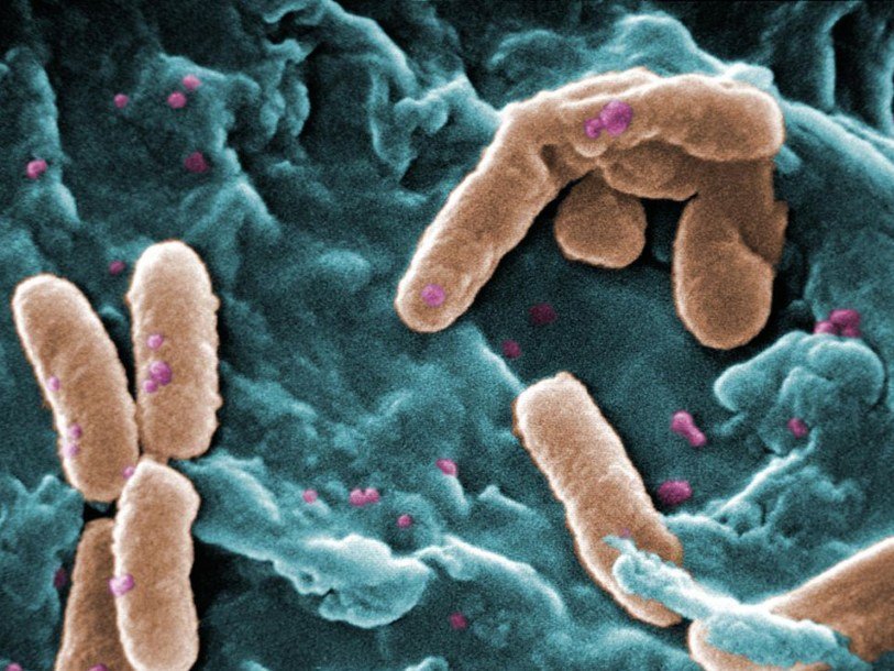 Pseudomonas aeruginosa