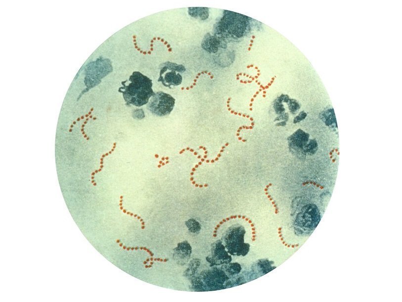 Бактерии Streptococcus pyogenes под микроскопом