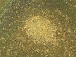 Стволовые клетки человека (в центре)