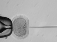 Инъекция комплекса CRISPR в яйцеклетку