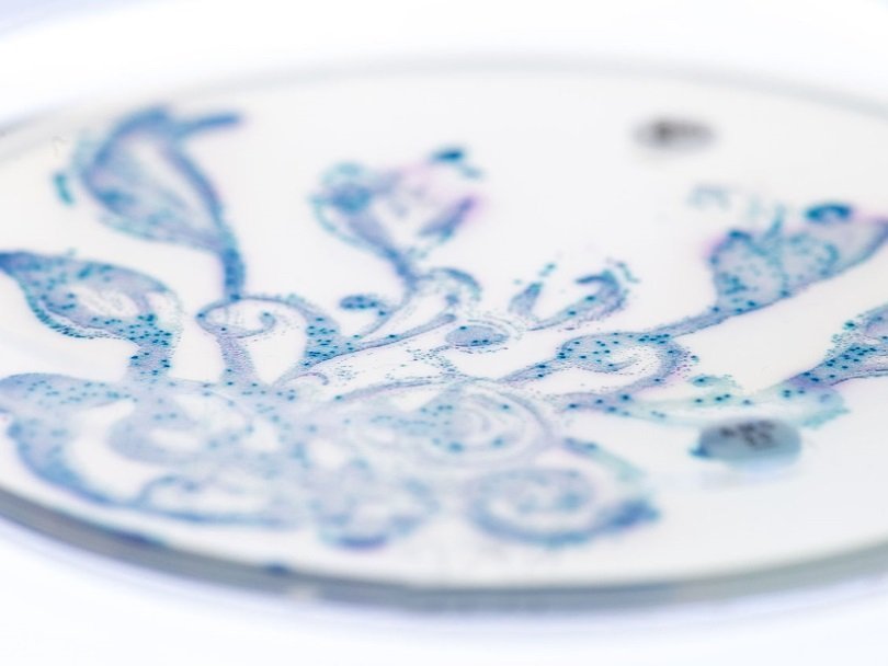 Кишечные бактерии в чашке Петри