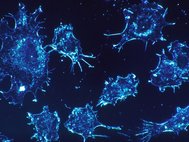 Клетки раковой опухоли
